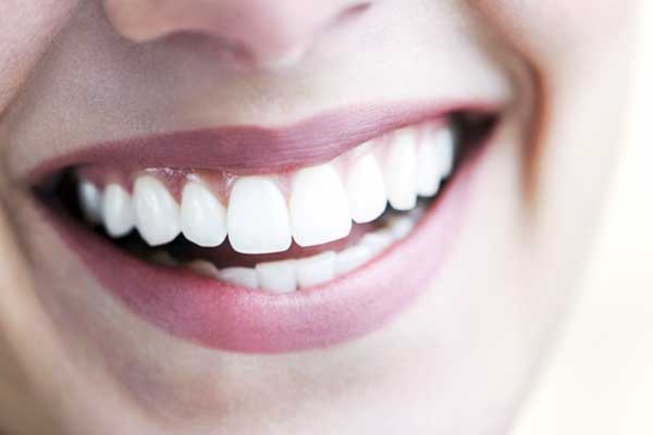 Transform Your Smile: Comprehensive Guide to Dental Work in Turkey