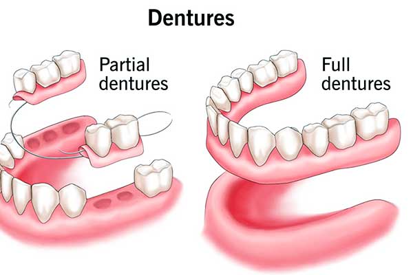 dentures turkey cost