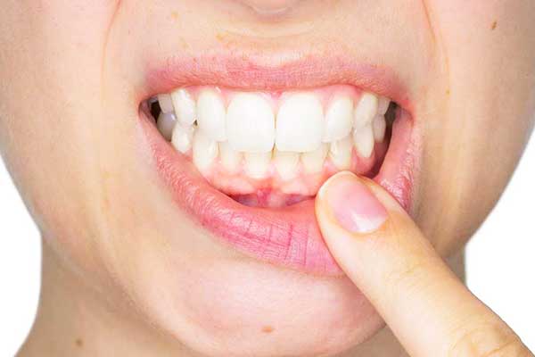 gum treatment in istanbul