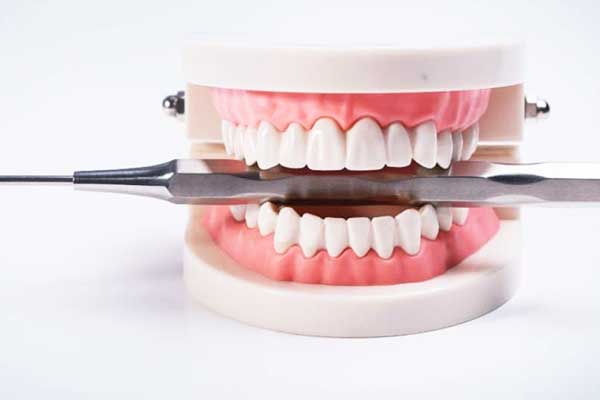 How Long Does It Take to Get Dentures in Turkey? A Comprehensive Guide