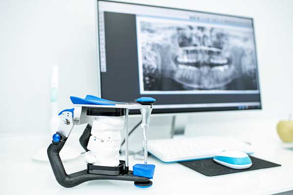 Cutting-Edge Dental Care: Innovative Dental Technologies Turkey