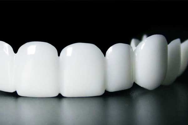 removable veneers in turkey