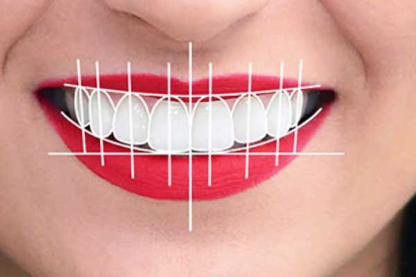 Transform Your Smile: Comprehensive Guide to Smile Makeovers Istanbul