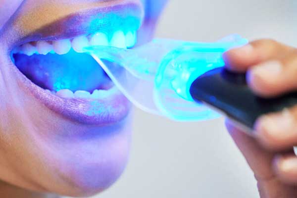 Brighten Your Smile: Zoom Teeth Whitening in Turkey