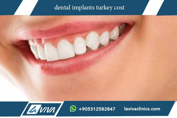 dental implants turkey cost