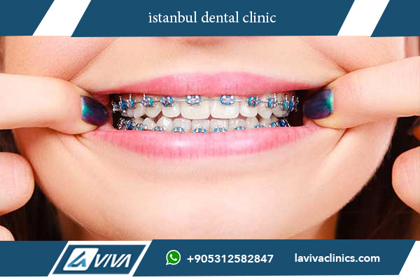 Complete Guide to Istanbul Dental Clinic: 5 Positive Outcomes You Can’t Ignore