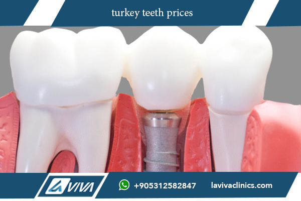 turkey teeth prices