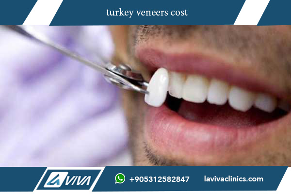 Turkey Veneers Cost: 10 Key Benefits That Will Make You Smile