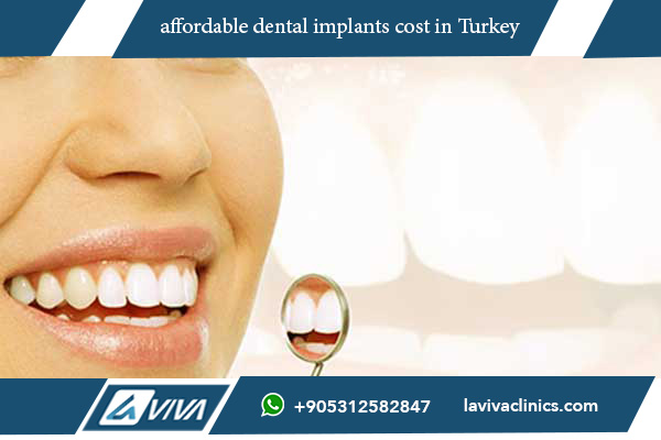 affordable dental implants cost