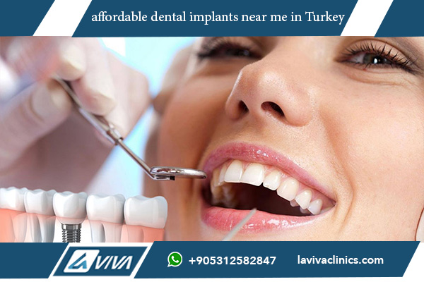 affordable dental implants near me