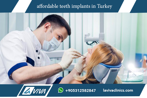 affordable teeth implants