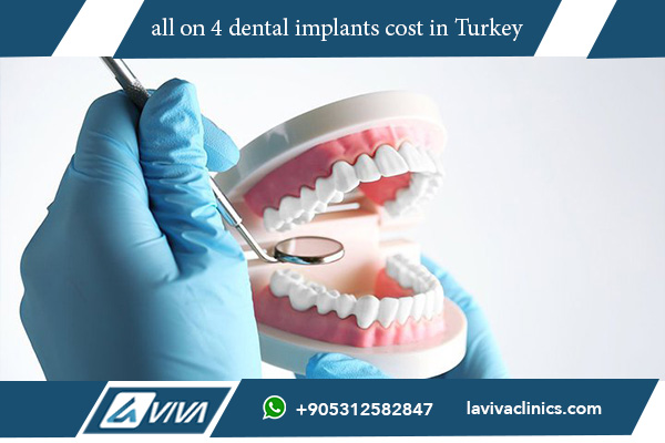 all on 4 dental implants cost