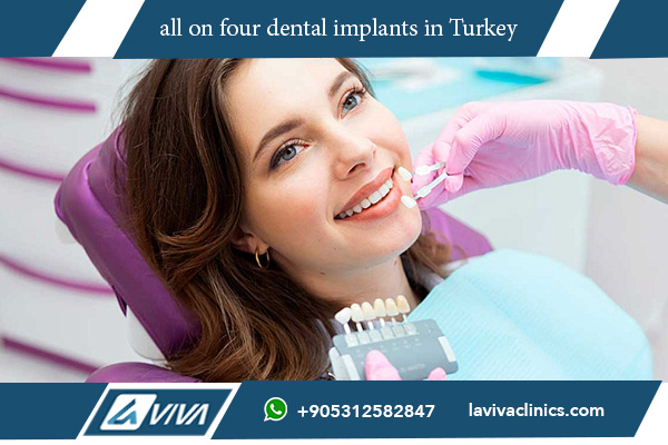 all on four dental implants