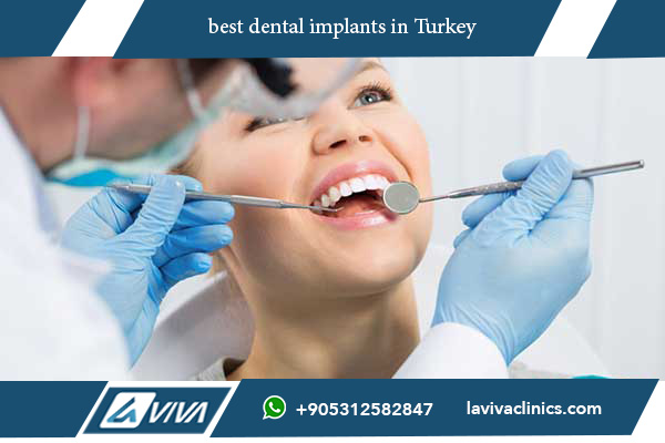 best dental implants