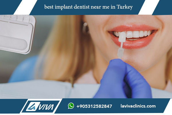 best implant dentist near me