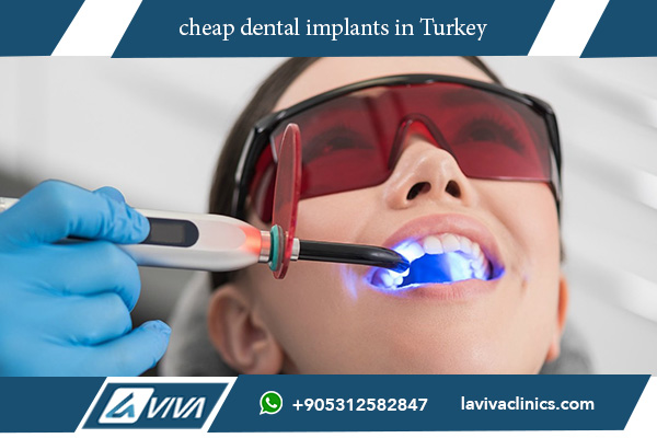 cheap dental implants