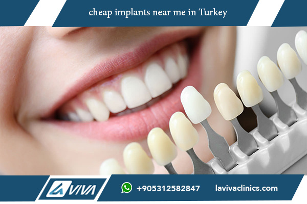 Discover Affordable Dental Implants Near Me: A Comprehensive Guide