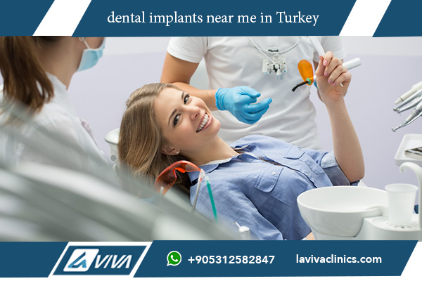 dental implants near me