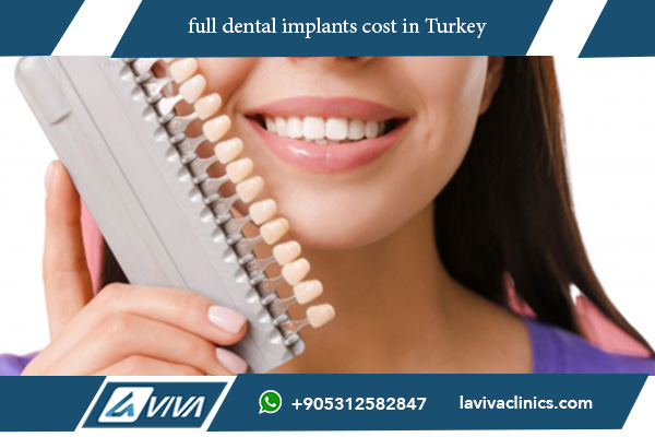 full dental implants cost