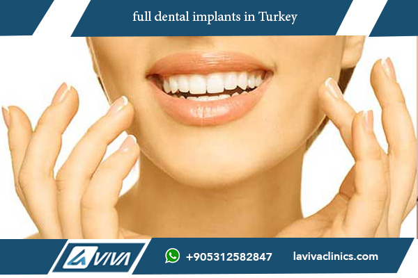 full dental implants