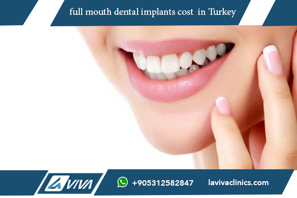 full mouth dental implants cost cheapest