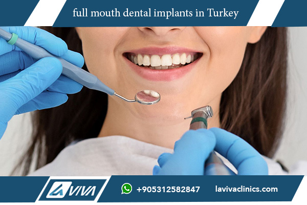 full mouth dental implants