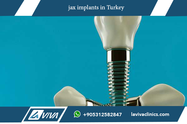 jax implants