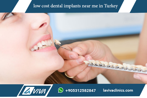 low cost dental implants near me