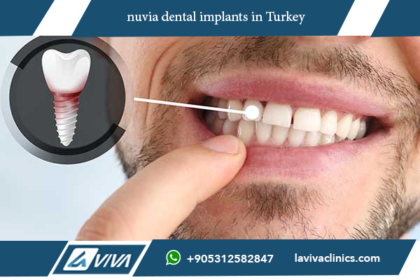 nuvia dental implants