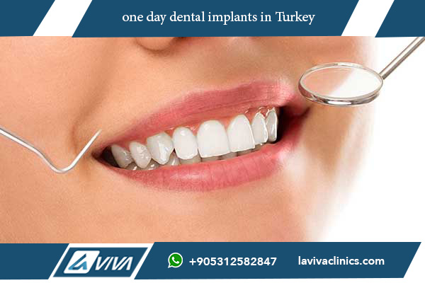 one day dental implants