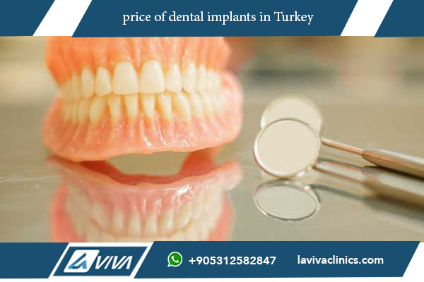 price of dental implants