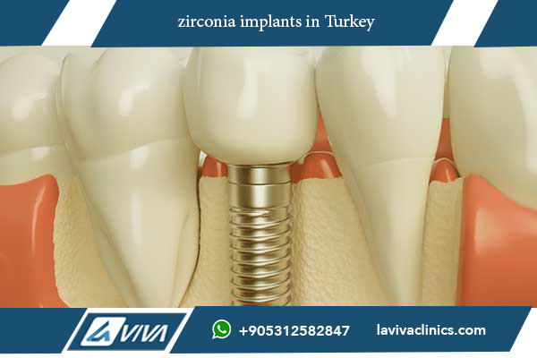 zirconia implants