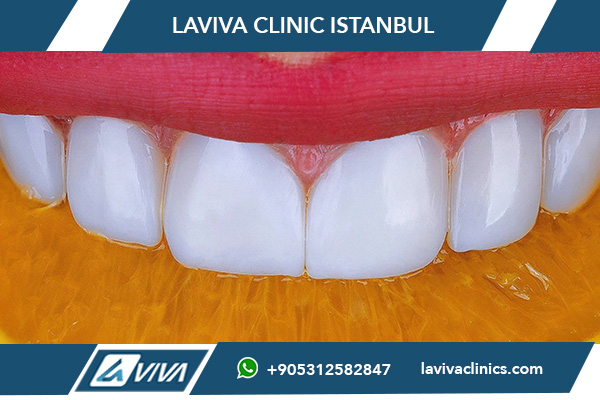 dental services in Turkey vs United States, dental implants Turkey vs USA, cost of dental treatments in Turkey, best dental clinics in Turkey, dental veneers price comparison Turkey vs USA, Hollywood smile Turkey vs USA, why choose Turkey for dental care, affordable dental care in Turkey, dental tourism in Turkey benefits, Laviva Clinic best dental treatments