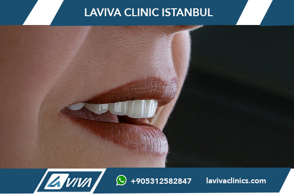 dental services in turkey vs ireland, affordable dental implants turkey, dental veneers turkey vs ireland cost, best dental clinics in turkey, dental tourism turkey vs ireland, full hollywood smile turkey vs ireland, why choose turkey for dental treatment, cost of dental implants in turkey vs ireland, best dental treatments abroad, dental care comparison turkey vs ireland