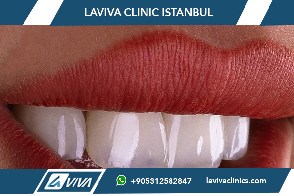 dental services in Turkey vs Australia, Turkey vs Australia dental prices, best dental clinics in Turkey, affordable dental implants Turkey, veneers cost Turkey vs Australia, full mouth restoration Turkey vs Australia, Turkey dental tourism reviews, dental treatment comparison Turkey vs Australia, is Turkey safe for dental implants, why choose Turkey for dental care