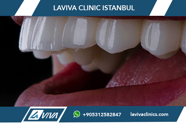 dental services Turkey vs. New Zealand, Turkey vs. New Zealand dental care, affordable dental treatments Turkey, best dental clinics in Turkey, dental implants Turkey vs. New Zealand, veneers cost Turkey vs. New Zealand, dental tourism in Turkey, dental treatment quality Turkey vs. New Zealand, Turkey dental costs vs. New Zealand, why choose Turkey for dental treatments