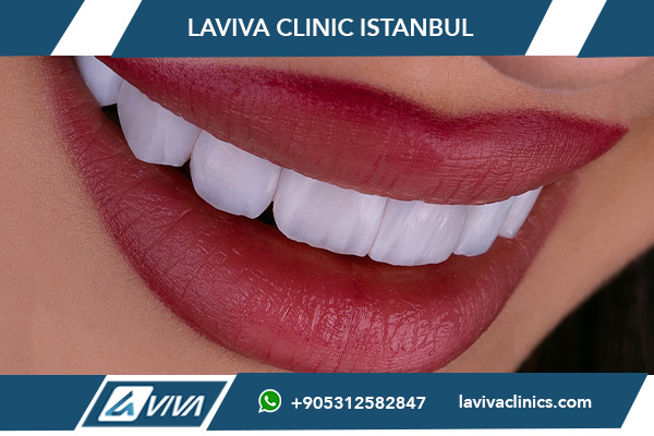 best dental clinics for veneers in Turkey, dental veneers Turkey, Turkey veneer prices, Hollywood smile Turkey, best dentists in Turkey, E-max veneers Turkey, zirconium veneers Turkey, composite veneers Turkey, affordable veneers Turkey, Turkey dental tourism, dental veneer cost comparison, dental clinics Istanbul, dental clinics Antalya, dental clinics Izmir, dental smile makeover, cosmetic dentistry Turkey, best veneer dentists, smile transformation Turkey