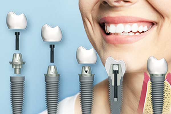 Facings Turkije Slijpen