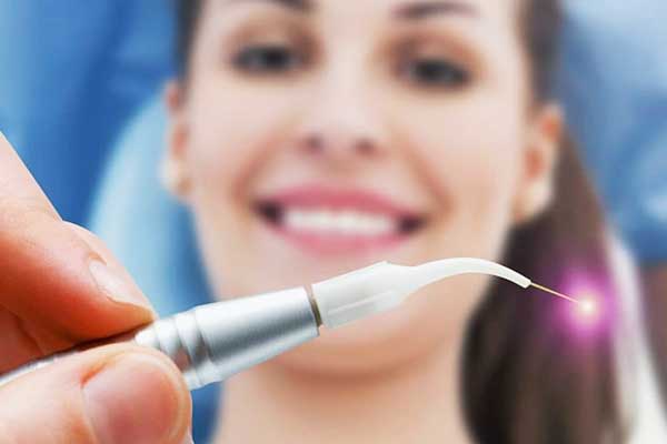 Hollywood-smile in Turkije