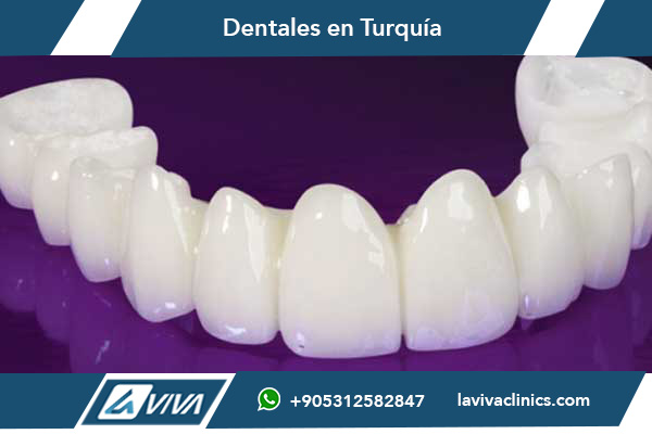 Best Veneers in Turkey