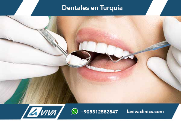 Full Mouth Dental Implants in Turkey