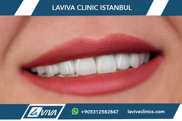 Zubní fazety Turecko