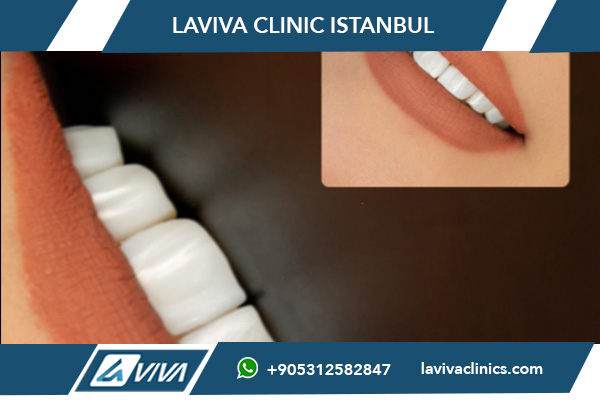 Zuby Turecko Klinika