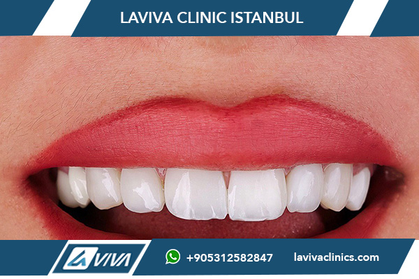 Specialista na implantáty Turecko