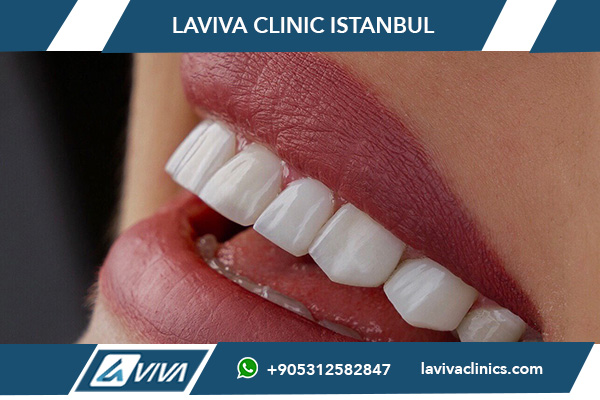 Komplet nové zuby cena Turecko