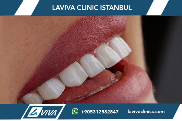 prix implants dentaires france turquie