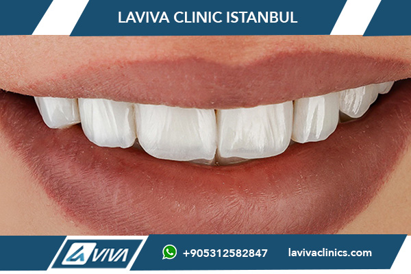 opiniones dentistas turquia experiencias